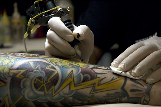 Tattoo Removal